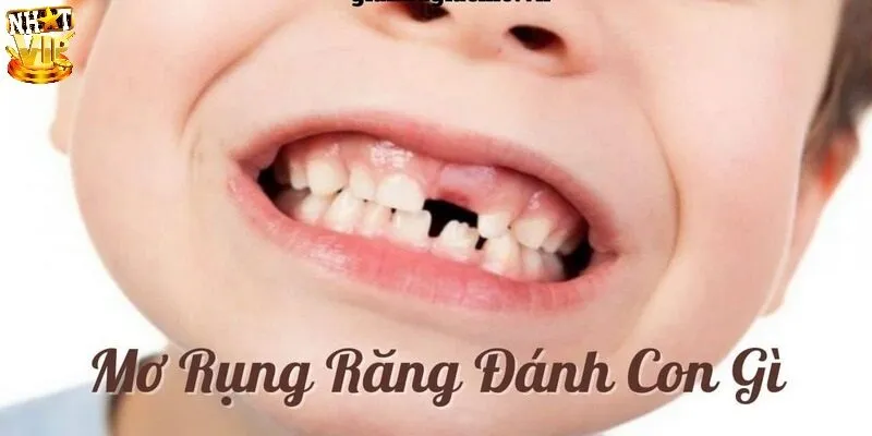 Mơ Thấy Răng Rụng - Giải Mã Điềm Báo Và Con Số May Mắn Mơ Thấy Răng Rụng - Giải Mã Điềm Báo Và Con Số May Mắn